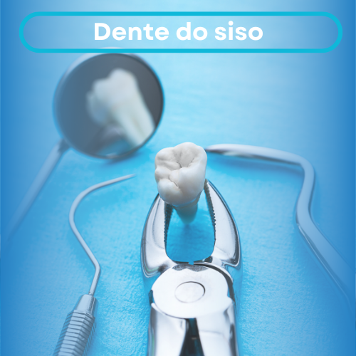 Imagem ilustrativa de um dente do siso e sua localização na arcada dentária, destacando a importância da avaliação odontológica para determinar a necessidade de extração.